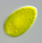 Gonyostomum_cell